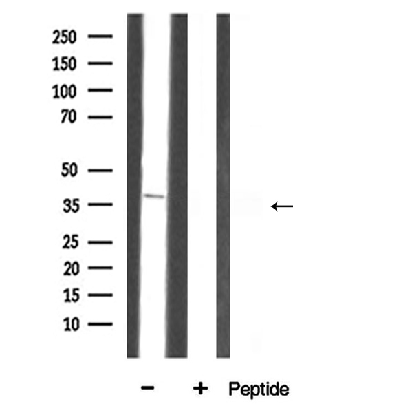 ANXA3 / Annexin A3 Antibody - Western blot analysis of Annexin III antibody expression in rat liver tissue lysates. The lane on the right is treated with the antigen-specific peptide.