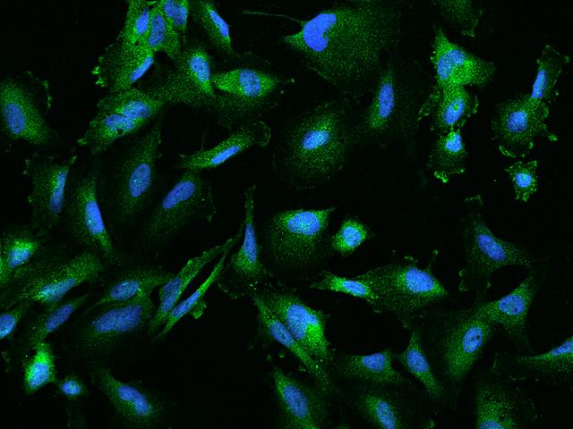 ANXA3 / Annexin A3 Antibody - Immunofluorescence staining of ANXA3 in U251MG cells. Cells were fixed with 4% PFA, permeabilzed with 0.1% Triton X-100 in PBS, blocked with 10% serum, and incubated with rabbit anti-Human ANXA3 polyclonal antibody (dilution ratio 1:200) at 4°C overnight. Then cells were stained with the Alexa Fluor 488-conjugated Goat Anti-rabbit IgG secondary antibody (green) and counterstained with DAPI (blue). Positive staining was localized to Cytoplasm.