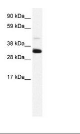 ANXA3 / Annexin A3 Antibody - Placenta Lysate.  This image was taken for the unconjugated form of this product. Other forms have not been tested.