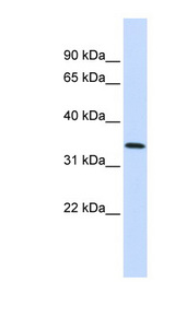 ANXA4 / Annexin IV Antibody - ANXA4 / Annexin IV antibody western blot of Fetal Lung lysate.  This image was taken for the unconjugated form of this product. Other forms have not been tested.