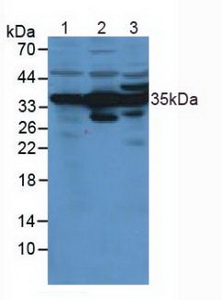 ANXA4 / Annexin IV Antibody - Western Blot; Lane1: Rat Kidney Tissue; Lane2: Human Liver Tissue; Lane3: Rat Prostate Gland Tissue.