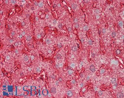 ANXA4 / Annexin IV Antibody - Human Liver: Formalin-Fixed, Paraffin-Embedded (FFPE).  This image was taken for the unconjugated form of this product. Other forms have not been tested.