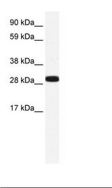 ANXA4 / Annexin IV Antibody - Placenta Lysate.  This image was taken for the unconjugated form of this product. Other forms have not been tested.
