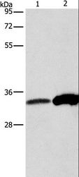 ANXA4 / Annexin IV Antibody - Western blot analysis of Raw264.7 cell and human fetal liver tissue, using ANXA4 Polyclonal Antibody at dilution of 1:500.