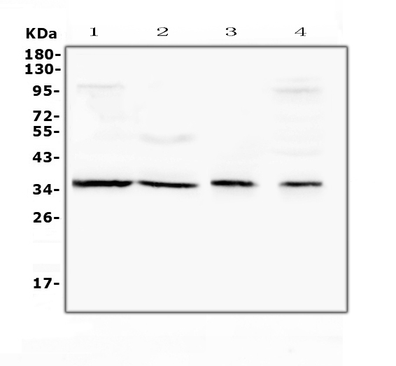 ANXA4 / Annexin IV Antibody - Western blot analysis of Annexin IV using anti-Annexin IV antibody. Electrophoresis was performed on a 5-20% SDS-PAGE gel at 70V (Stacking gel) / 90V (Resolving gel) for 2-3 hours. The sample well of each lane was loaded with 50ug of sample under reducing conditions. Lane 1: rat liver tissue lysates, Lane 2: rat kidney tissue lysates, Lane 3: mouse liver tissue lysates, Lane 4: mouse kidney tissue lysates. After Electrophoresis, proteins were transferred to a Nitrocellulose membrane at 150mA for 50-90 minutes. Blocked the membrane with 5% Non-fat Milk/ TBS for 1.5 hour at RT. The membrane was incubated with rabbit anti-Annexin IV antigen affinity purified polyclonal antibody at 0.5 µg/mL overnight at 4°C, then washed with TBS-0.1% Tween 3 times with 5 minutes each and probed with a goat anti-rabbit IgG-HRP secondary antibody at a dilution of 1:10000 for 1.5 hour at RT. The signal is developed using an Enhanced Chemiluminescent detection (ECL) kit with Tanon 5200 system. A specific band was detected for Annexin IV at approximately 36KD. The expected band size for Annexin IV is at 36KD.