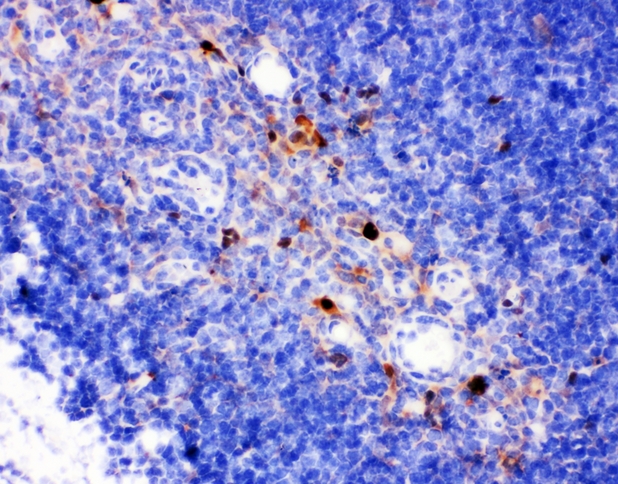 ANXA4 / Annexin IV Antibody - IHC analysis of Annexin IV using anti-Annexin IV antibody. Annexin IV was detected in paraffin-embedded section of mouse thymus tissues. Heat mediated antigen retrieval was performed in citrate buffer (pH6, epitope retrieval solution) for 20 mins. The tissue section was blocked with 10% goat serum. The tissue section was then incubated with 1µg/ml rabbit anti-Annexin IV Antibody overnight at 4°C. Biotinylated goat anti-rabbit IgG was used as secondary antibody and incubated for 30 minutes at 37°C. The tissue section was developed using Strepavidin-Biotin-Complex (SABC) with DAB as the chromogen.