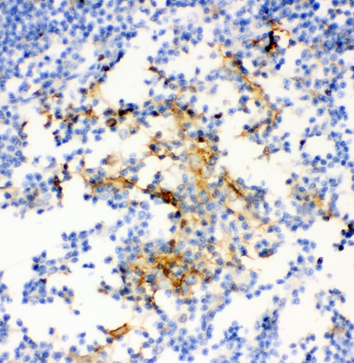 ANXA4 / Annexin IV Antibody - IHC analysis of Annexin IV using anti-Annexin IV antibody. Annexin IV was detected in paraffin-embedded section of rat thymus tissues. Heat mediated antigen retrieval was performed in citrate buffer (pH6, epitope retrieval solution) for 20 mins. The tissue section was blocked with 10% goat serum. The tissue section was then incubated with 1µg/ml rabbit anti-Annexin IV Antibody overnight at 4°C. Biotinylated goat anti-rabbit IgG was used as secondary antibody and incubated for 30 minutes at 37°C. The tissue section was developed using Strepavidin-Biotin-Complex (SABC) with DAB as the chromogen.