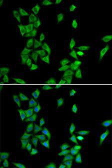 ANXA4 / Annexin IV Antibody - Immunofluorescence analysis of HeLa cells using ANXA4 antibody. Blue: DAPI for nuclear staining.