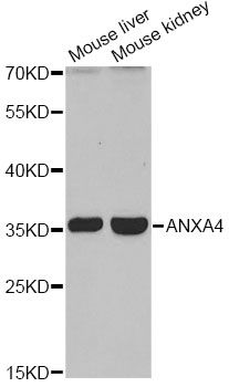 ANXA4 / Annexin IV Antibody - Western blot analysis of extracts of various cell lines, using ANXA4 antibody at 1:1000 dilution. The secondary antibody used was an HRP Goat Anti-Rabbit IgG (H+L) at 1:10000 dilution. Lysates were loaded 25ug per lane and 3% nonfat dry milk in TBST was used for blocking. An ECL Kit was used for detection and the exposure time was 60s.
