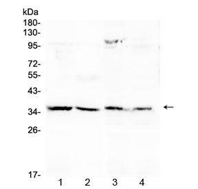 ANXA4 / Annexin IV Antibody - Western blot testing of 1) rat liver, 2) rat kidney, 3) mouse liver and 4) mouse kidney with Annexin IV antibody at 0.5ug/ml. Predicted molecular weight ~36 kDa.