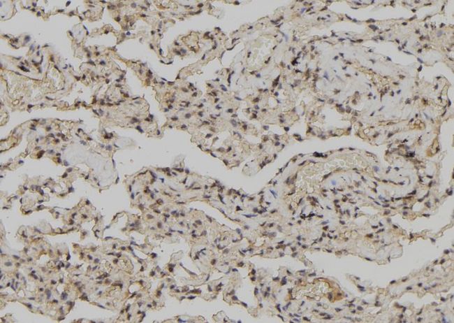 ANXA4 / Annexin IV Antibody - 1:100 staining human lung tissue by IHC-P. The sample was formaldehyde fixed and a heat mediated antigen retrieval step in citrate buffer was performed. The sample was then blocked and incubated with the antibody for 1.5 hours at 22°C. An HRP conjugated goat anti-rabbit antibody was used as the secondary.