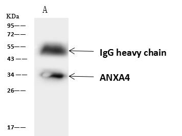 ANXA4 / Annexin IV Antibody - ANXA4 was immunoprecipitated using: Lane A: 0.5 mg HepG2 Whole Cell Lysate. 4 uL anti-ANXA4 rabbit polyclonal antibody and 60 ug of Immunomagnetic beads Protein A/G. Primary antibody: Anti-ANXA4 rabbit polyclonal antibody, at 1:100 dilution. Secondary antibody: Goat Anti-Rabbit IgG (H+L)/HRP at 1/10000 dilution. Developed using the ECL technique. Performed under reducing conditions. Predicted band size: 36 kDa. Observed band size: 34 kDa.