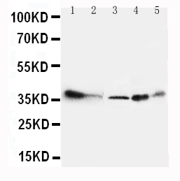 ANXA4 / Annexin IV Antibody - WB of ANXA4 / Annexin IV antibody. All lanes: Anti-Annexin A4 at 0.5ug/ml. Lane 1: Human Placenta Tissue Lysate at 40ug. Lane 2: Rat Liver Tissue Lysate at 40ug. Lane 3: 293T Whole Cell Lysate at 40ug. Lane 4: HEPA Whole Cell Lysate at 40ug. Lane 5: NIH3T3 Whole Cell Lysate at 40ug. Predicted bind size: 36KD. Observed bind size: 36KD.