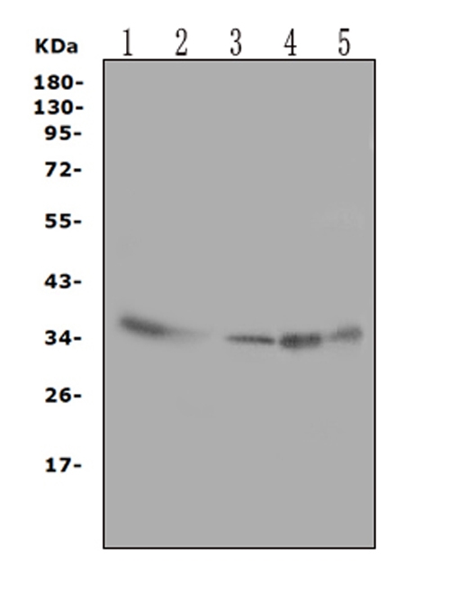 ANXA4 / Annexin IV Antibody - Anti-Annexin IV antibody, Western blotting Lane 1: Human Placenta Tissue LysateLane 2: Rat Liver Tissue LysateLane 3: 293T Cell LysateLane 4: HEPA Cell LysateLane 5: NIH3T3 Cell Lysate