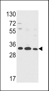 ANXA5 / Annexin V Antibody - Western blot of Annexin V Antibody in HepG2,A2058,T47D cell line lysates (35 ug/lane). ANXA5 (arrow) was detected using the purified antibody.
