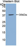 ANXA5 / Annexin V Antibody - Western blot of recombinant ANXA5 / Annexin V.  This image was taken for the unconjugated form of this product. Other forms have not been tested.