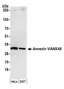 ANXA5 / Annexin V Antibody - Detection of human Annexin V/ANXA5 by western blot. Samples: Whole cell lysate (50 µg) from HeLa and 293T cells prepared using NETN lysis buffer. Antibody: Affinity purified rabbit anti-Annexin V/ANXA5 antibody used for WB at 0.1 µg/ml. Detection: Chemiluminescence with an exposure time of 30 seconds.