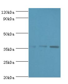 ANXA5 / Annexin V Antibody - Western blot. All lanes: Annexin A5 antibody at 2 ug/ml. Lane 1: HeLa whole cell lysate Lane 2: A431 whole cell lysate Lane 3: HepG2 whole cell lysate. Secondary antibody: goat polyclonal to rabbit at 1:10000 dilution. Predicted band size: 36 kDa. Observed band size: 36 kDa.  This image was taken for the unconjugated form of this product. Other forms have not been tested.