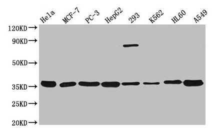 ANXA5 / Annexin V Antibody - Western Blot Positive WB detected in: Hela whole cell lysate, MCF-7 whole cell lysate, PC3 whole cell lysate, HepG2 whole cell lysate, 293 whole cell lysate, K562 whole cell lysate, HL-60 whole cell lysate, A549 whole cell lysate All lanes: ANXA5 antibody at 1:3000 Secondary Goat polyclonal to rabbit IgG at 1/50000 dilution Predicted band size: 36 kDa Observed band size: 36 kDa