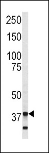 ANXA5 / Annexin V Antibody - Western blot of Annexin V antibody in SK-Br-3 cell line lysates (35 ug/lane). Annexin V (arrow) was detected using the purified antibody.
