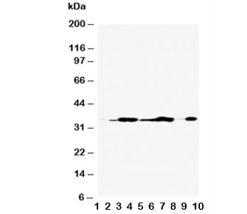 ANXA5 / Annexin V Antibody - Western blot testing of Annexin V antibody and Lane 1: rat brain; 2: rat skeletal muscle; 3: rat ovary; 4: rat lung; 5: MCF-7; 6: SMMC-7721; 7: A549; 8: Jurkat; 9: SGC; 10: HT1080; Predicted molecular weight ~36 kDa.