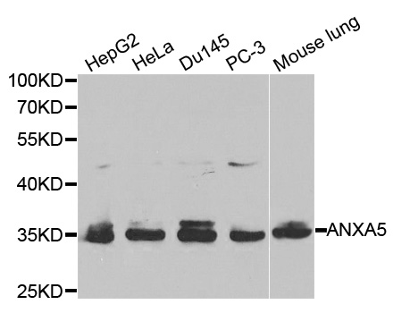 ANXA5 / Annexin V Antibody - Western blot analysis of extracts of various cell lines, using ANXA5 antibody at 1:1000 dilution. The secondary antibody used was an HRP Goat Anti-Rabbit IgG (H+L) at 1:10000 dilution. Lysates were loaded 25ug per lane and 3% nonfat dry milk in TBST was used for blocking.
