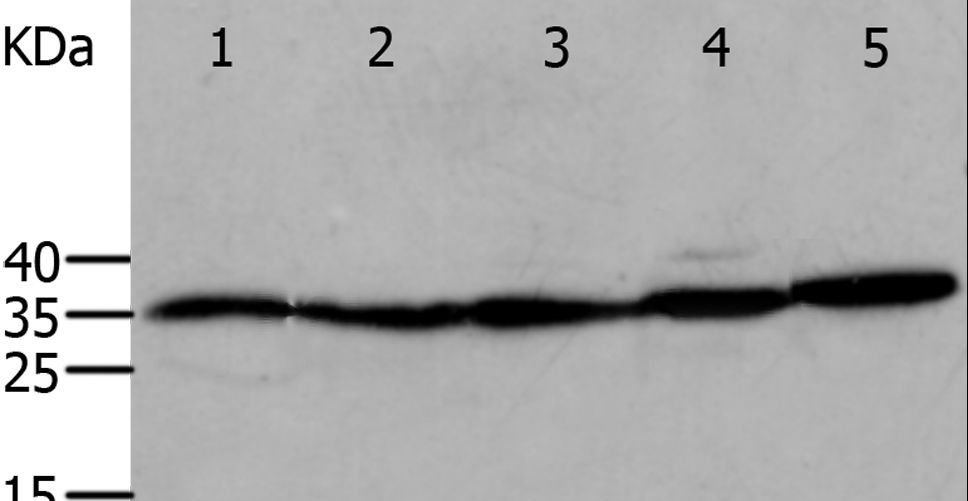 ANXA5 / Annexin V Antibody - Western blot analysis of Mouse eyes and heart, Human cervical cancer tissue, OP9 and RAW264.7 cell, using ANXA5 Polyclonal Antibody at dilution of 1:750.