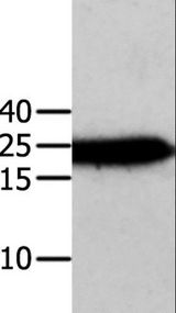 ANXA5 / Annexin V Antibody - Western blot analysis of Human cervical cancer tissue, using ANXA5 Polyclonal Antibody at dilution of 1:750.