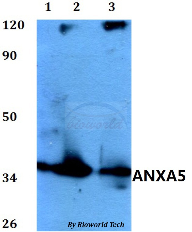 ANXA5 / Annexin V Antibody - Western blot of ANXA5 antibody at 1:500 dilution. Lane 1: HEK293T whole cell lysate. Lane 2: Raw264.7 whole cell lysate. Lane 3: PC12 whole cell lysate.