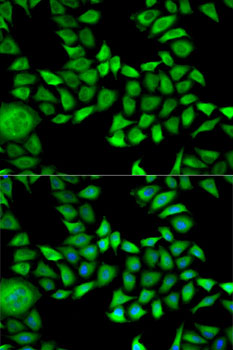 ANXA5 / Annexin V Antibody - Immunofluorescence analysis of HeLa cells using ANXA5 antibody. Blue: DAPI for nuclear staining.