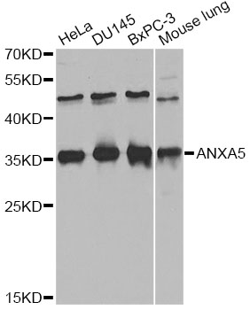 ANXA5 / Annexin V Antibody - Western blot analysis of extracts of various cell lines, using ANXA5 antibody at 1:1000 dilution. The secondary antibody used was an HRP Goat Anti-Rabbit IgG (H+L) at 1:10000 dilution. Lysates were loaded 25ug per lane and 3% nonfat dry milk in TBST was used for blocking.