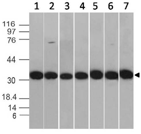 ANXA5 / Annexin V Antibody - Fig-1: Western blot analysis of Annexin V. Anti-Annexin V antibody was used at 0.01 µg/ml on (1) U87, (2) MCF-7, (3) Jurkat, (4) K562, (5) Hela, (6) HepG2 and (7) 3T3 lysates.