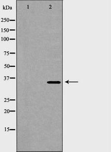 ANXA5 / Annexin V Antibody - Western blot analysis of extracts of HeLa cells using ANXA5 antibody. The lane on the left is treated with the antigen-specific peptide.