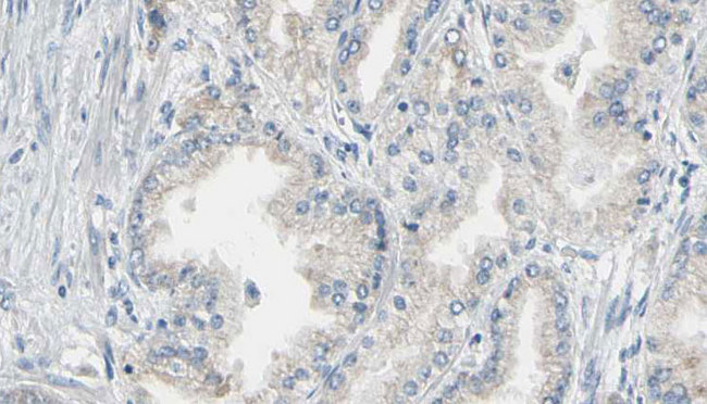 ANXA5 / Annexin V Antibody - 1:100 staining human prostate tissue by IHC-P. The sample was formaldehyde fixed and a heat mediated antigen retrieval step in citrate buffer was performed. The sample was then blocked and incubated with the antibody for 1.5 hours at 22°C. An HRP conjugated goat anti-rabbit antibody was used as the secondary.