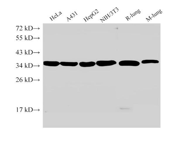 ANXA5 / Annexin V Antibody - Western Blot analysis of Hela cells, A431 cells, HepG2 cells, NIH/3T3 cells, Rat lung and Mouse lung using ANXA5 Ployclonal Antibody at dilution of 1:2000.