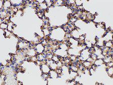 ANXA5 / Annexin V Antibody - Immunohistochemistry of paraffin-embedded Mouse lung using ANXA5 Polycloanl Antibody at dilution of 1:50.
