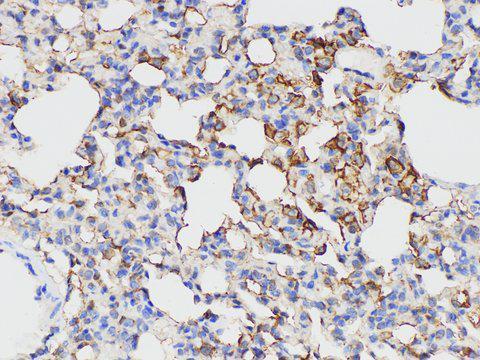 ANXA5 / Annexin V Antibody - Immunohistochemistry of paraffin-embedded Rat lung using ANXA5 Polycloanl Antibody at dilution of 1:50.