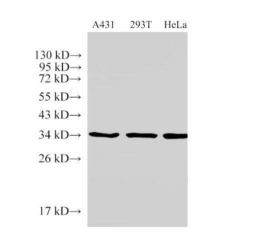 ANXA5 / Annexin V Antibody - Western Blot analysis of A431 cells, 293T cells and Hela cells using ANXA5 Polyclonal Antibody at dilution of 1:500.