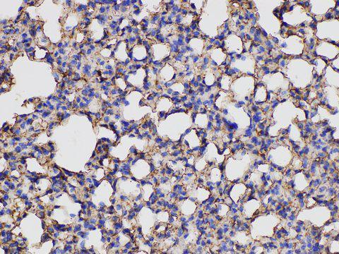 ANXA5 / Annexin V Antibody - Immunohistochemistry of paraffin-embedded Mouse lung using ANXA5 Polycloanl Antibody at dilution of 1:150.