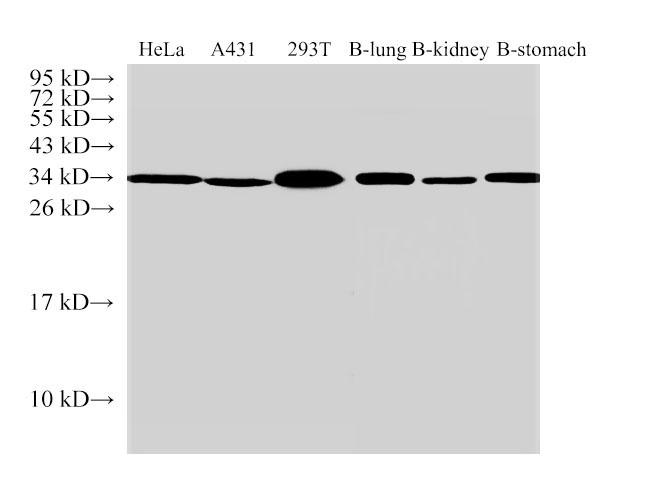 ANXA5 / Annexin V Antibody - Western Blot analysis of Hela cells, A431 cells, 293T cells, Bovine lung, Bovine kidney and Bovine stomach using ANXA5 Polyclonal Antibody at dilution of 1:500.