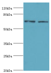 ANXA6/Annexin A6/Annexin VI Antibody - Western blot. All lanes: Annexin A6 antibody at 4 ug/ml. Lane 1: Jurkat whole cell lysate. Lane 2: HeLa whole cell lysate. Secondary antibody: Goat polyclonal to rabbit at 1:10000 dilution. Predicted band size: 76 kDa. Observed band size: 76 kDa.