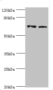 ANXA6/Annexin A6/Annexin VI Antibody - Western blot All lanes: Annexin A6 antibody at 4µg/ml Lane 1: Jurkat whole cell lysate Lane 2: Hela whole cell lysate Secondary Goat polyclonal to rabbit IgG at 1/10000 dilution Predicted band size: 76, 73 kDa Observed band size: 76 kDa