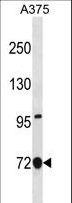 ANXA6/Annexin A6/Annexin VI Antibody - ANXA6 Antibody western blot of A375 cell line lysates (35 ug/lane). The ANXA6 antibody detected the ANXA6 protein (arrow).