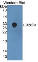 ANXA6/Annexin A6/Annexin VI Antibody - Western blot of ANXA6/Annexin A6/Annexin VI antibody.