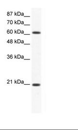 ANXA6/Annexin A6/Annexin VI Antibody - Jurkat Cell Lysate.  This image was taken for the unconjugated form of this product. Other forms have not been tested.