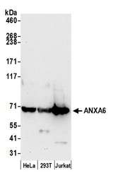 ANXA6/Annexin A6/Annexin VI Antibody - Detection of human ANXA6 by western blot. Samples: Whole cell lysate (50 µg) from HeLa, HEK293T, and Jurkat cells prepared using NETN lysis buffer. Antibody: Affinity purified rabbit anti-ANXA6 antibody used for WB at 0.1 µg/ml. Detection: Chemiluminescence with an exposure time of 30 seconds.
