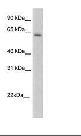 ANXA6/Annexin A6/Annexin VI Antibody - SP2/0 Cell Lysate.  This image was taken for the unconjugated form of this product. Other forms have not been tested.