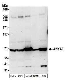ANXA6/Annexin A6/Annexin VI Antibody - Detection of human and mouse ANXA6 by western blot. Samples: Whole cell lysate (50 µg) from HeLa, HEK293T, Jurkat, mouse TCMK-1, and mouse NIH 3T3 cells prepared using NETN lysis buffer. Antibody: Affinity purified rabbit anti-ANXA6 antibody used for WB at 0.1 µg/ml. Detection: Chemiluminescence with an exposure time of 30 seconds.