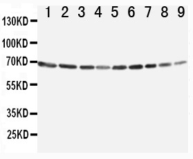 ANXA6/Annexin A6/Annexin VI Antibody - WB of ANXA6/Annexin A6/Annexin VI antibody. All lanes: Anti-ANXA6 at 0.5ug/ml. Lane 1: Rat Ovary Tissue Lysate at 40ug. Lane 2: Rat Liver Tissue Lysate at 40ug. Lane 3: Rat Intestinum Tenue Tissue Lysate at 40ug. Lane 4: Rat Brain Tissue Lysate at 40ug. Lane 5: A549 Whole Cell Lysate at 40ug. Lane 6: JURKAT Whole Cell Lysate at 40ug. Lane 7: RAJI Whole Cell Lysate at 40ug. Lane 8: CEM Whole Cell Lysate at 40ug. Lane 9: SMMC Whole Cell Lysate at 40ug. Predicted bind size: 76KD. Observed bind size: 68KD.