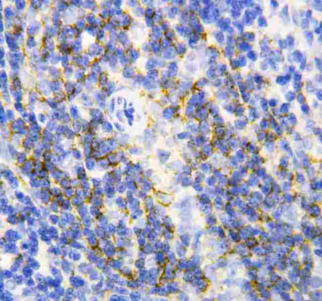 ANXA6/Annexin A6/Annexin VI Antibody - Anti-Annexin VI antibody, IHC(P): Rat Spleen Tissue